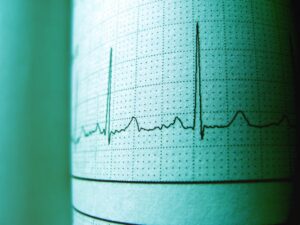 Ações da BioCardia Disparam Após Avanço com FDA